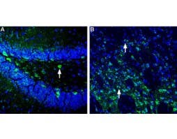 Anti-Homer1 Antibody