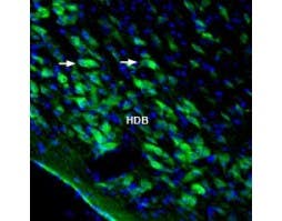Anti-Homer3 Antibody