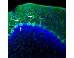 Anti-AKAP12 Antibody