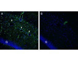 Anti-Gamma-Synuclein Antibody