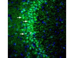 Anti-DLGAP1/GKAP Antibody
