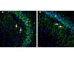 Anti-GIPC1 Antibody