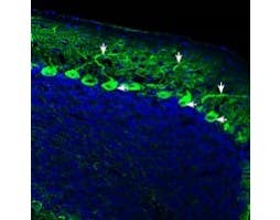 Anti-IQGAP1 Antibody