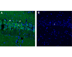 Anti-Synaptojanin 1 Antibody