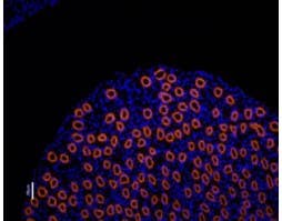 Anti-Aquaporin 2-ATTO Fluor-550 Antibody