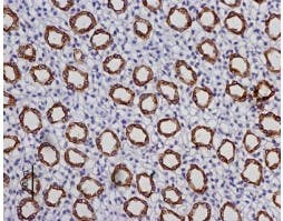 Anti-Aquaporin 2 Antibody