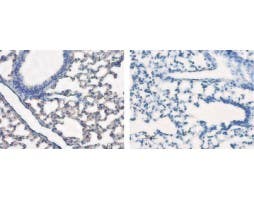 Anti-Aquaporin 5 Antibody