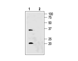Anti-Aquaporin 6 Antibody