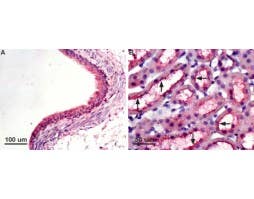 Anti-Aquaporin 7 Antibody