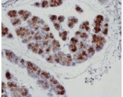 Anti-Aquaporin 8 Antibody