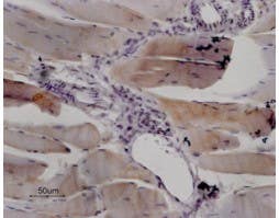 Anti-Ryanodine Receptor 1 Antibody