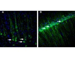 Anti-RAMP1 (extracellular) Antibody