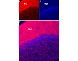 Anti-SCN1A (Na<sub>V</sub>1.1)-ATTO Fluor-594 Antibody