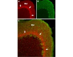 Anti-SCN1A (Na<sub>V</sub>1.1) Antibody