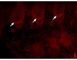 Anti-SCN3A (Na<sub>V</sub>1.3) Antibody