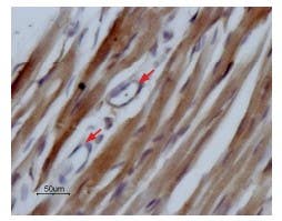 Anti-Na<sub>V</sub>1.5 (SCN5A) (493-511) Antibody