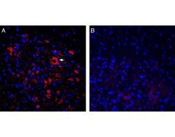Anti-ASIC2a Antibody