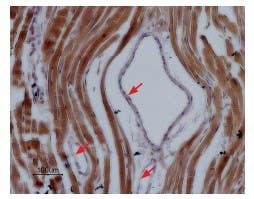 Anti-Na<sub>V</sub>1.5 (SCN5A) (1978-2016) Antibody