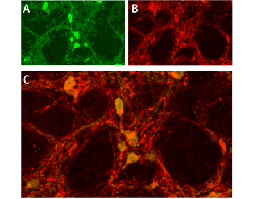 Anti-ASIC1 Antibody