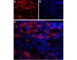 Anti-Na<sub>V</sub>1.8 (SCN10A)-ATTO Fluor-594 Antibody
