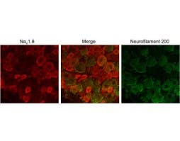 Anti-Na<sub>V</sub>1.8 (SCN10A) Antibody