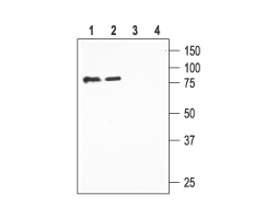 Anti-ENaC β (SCNN1B) (extracellular) Antibody