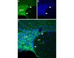 Anti-NALCN/VGCNL1 (extracellular) Antibody