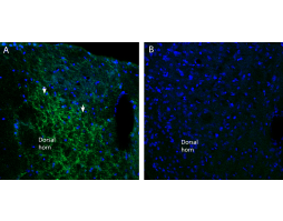 Anti-Na<sub>V</sub>1.7 (SCN9A) (extracellular) Antibody