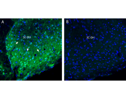 Anti-Na<sub>V</sub>1.8 (SCN10A) (extracellular) Antibody