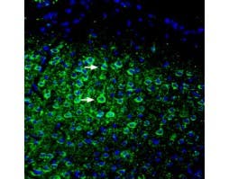 Anti-ASIC5 (extracellular) Antibody