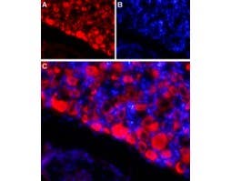 Anti-SCN4B (Na<sub>V</sub>β<sub>4</sub>) (extracellular) Antibody