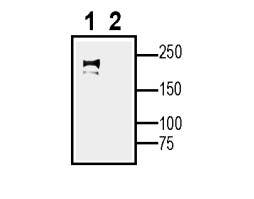 Anti-Na<sub>V</sub>1.5 (SCN5A) (extracellular) Antibody