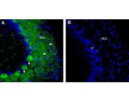 Anti-SCN1A (Na<sub>V</sub>1.1) (extracellular) Antibody