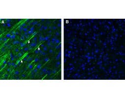 Anti-Somatostatin Receptor Type 1 (extracellular) Antibody