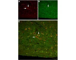 Anti-Somatostatin Receptor Type 3 Antibody