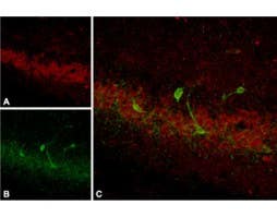 Anti-Somatostatin Receptor Type 4 (extracellular) Antibody