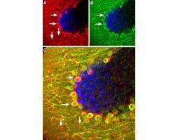 Anti-Somatostatin Receptor Type 5 (extracellular) Antibody