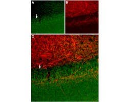 Anti-Somatostatin Receptor Type 2 (extracellular) Antibody