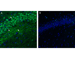 Anti-S1PR3 (EDG3) (extracellular) Antibody