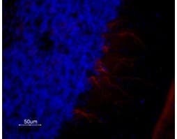 Anti-5HT1A Receptor (HTR1A) Antibody