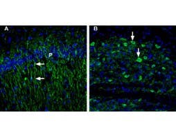 Anti-5HT1B Receptor (HTR1B) (extracellular) Antibody