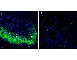 Anti-5HT1D Receptor (HTR1D) (extracellular) Antibody