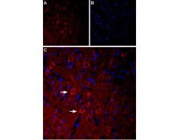 Anti-5HT3A Receptor (HTR3A) Antibody