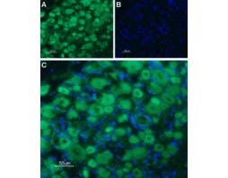 Anti-5HT3B Receptor (HTR3B) (extracellular) Antibody