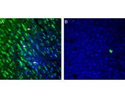 Anti-5HT2A Receptor (HTR2A) (extracellular) Antibody