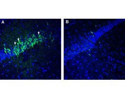 Anti-5HT2C Receptor (HTR2C) Antibody