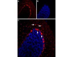 Anti-5HT2B Receptor (HTR2B) (extracellular) Antibody