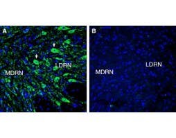 Anti-5HT7 Receptor/HTR7 (extracellular) Antibody