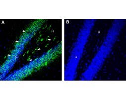 Anti-5HT6 Receptor (HTR6) (extracellular) Antibody