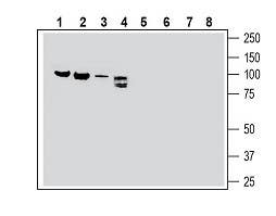 Anti-Semaphorin-3F Antibody